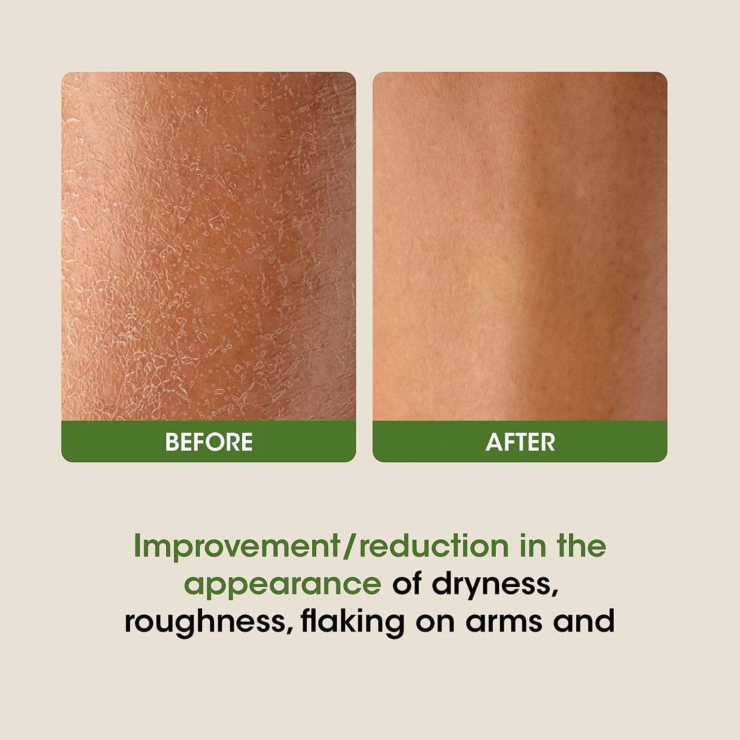 OG Beauty Science Aloe Vera Body Lotion (350ML / 1 Pc) OG Beauty Science Aloe Vera Body Lotion (350ML / 1 Pc)